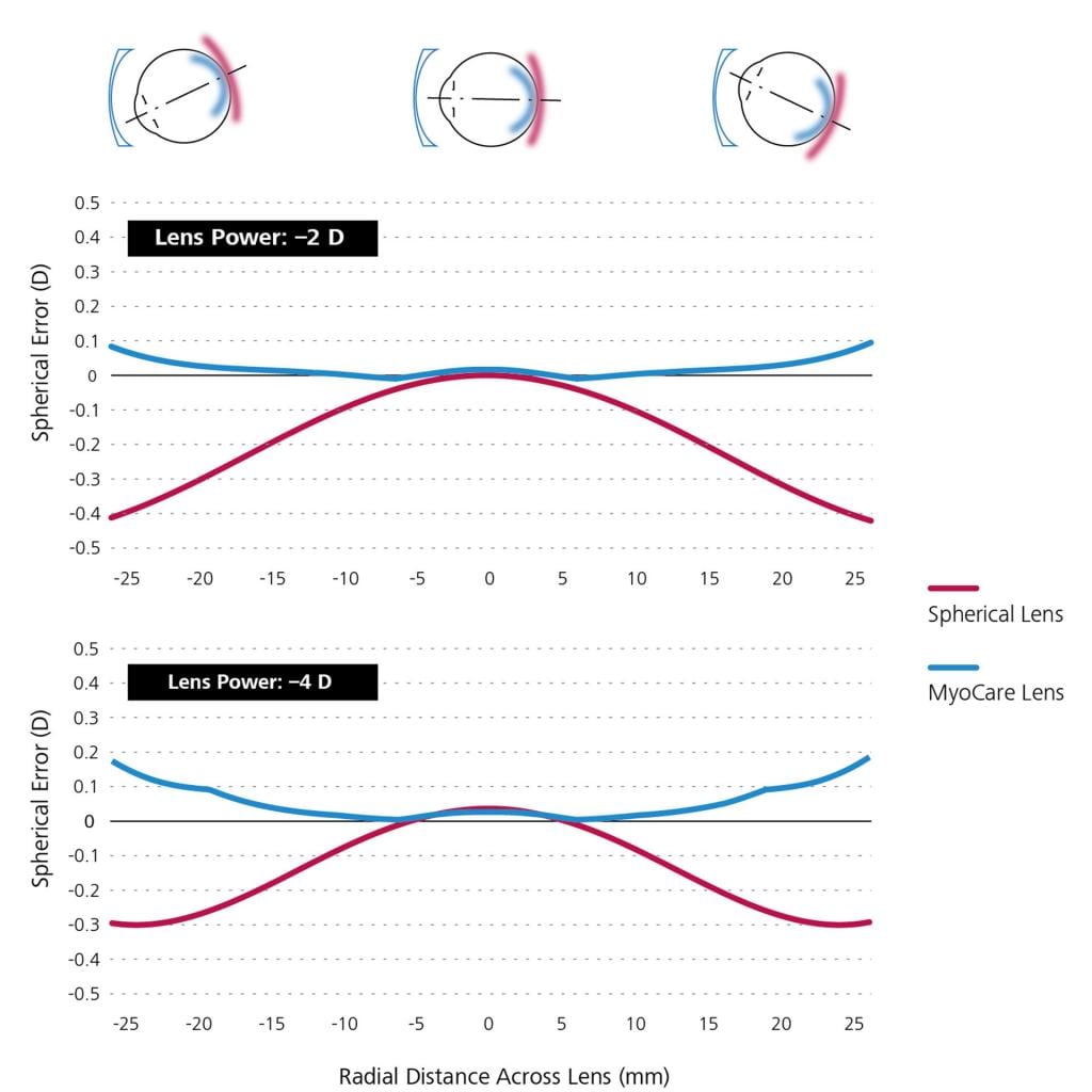 Las lentes ZEISS con recubrimiento DuraVision son mucho menos reflectantes.